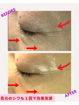 ユーフォリア(Euphoria)/目元のシワ改善にも効果的