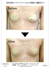 カナエル(QANAEL)/バストケアクリーム効果2