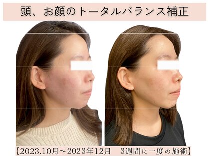 リボディニーニーゴ(RE.BODY225)の写真