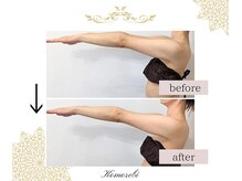 コモレビ(Komorebi)/