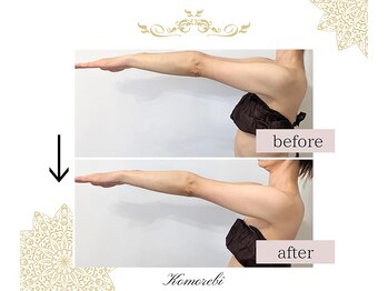 コモレビ(Komorebi)/