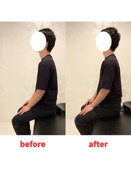 ナオル整体 福岡香椎院(NAORU整体)/30代男性施術事例【猫背】