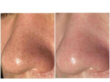 ソルエユニーク(Le seul et unique)