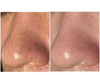 ソルエユニーク(Le seul et unique)