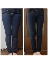 ガーネ 堺店(GARNE)/痩身・下半身痩せ/40代