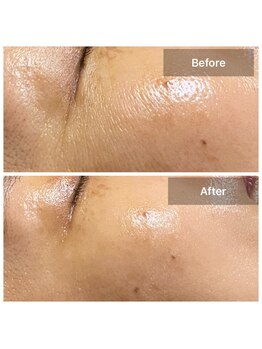 プライベートサロン アール(R)/ゾンビマスク