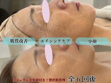 プリュボーテ(Pul Beaute)