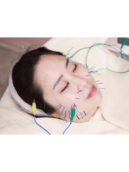 鍼灸施術を受けたい