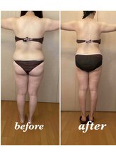 アンフィニ(infini)/ブライダルコース14回（8ヶ月）