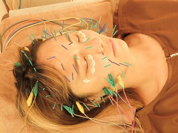 テンジンはり灸院(tenjinはり灸院)/パルスのコードを繋げます