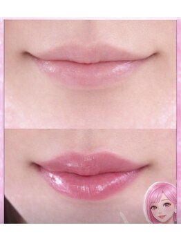 ビューティーツリー(Beauty Tree)/老化ストップ・最速で結果出し!