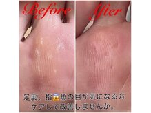 リ ビューティフル(Re Beautiful)の雰囲気（フットケア/フットネイル/春夏/足裏角質ケア/たこ魚の目/巻き爪）