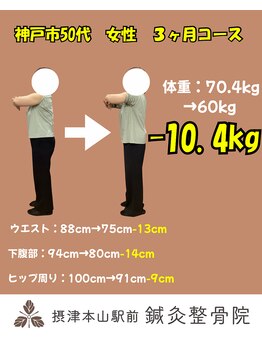 摂津本山駅前鍼灸整骨院/50代女性