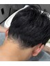 【後ろ姿で差がつく】うなじ&背中脱毛