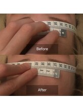 クレファ(CREFA)/美顔ヘッドスパ症例