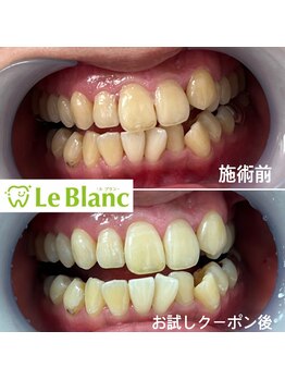 ルブラン 奈良店(Le Blanc)/【効果に自信があります】