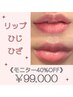 『話題のローマピンク』リップ/ひじ/ひざ/希望部位選択♪黒ずみをピンクに♪