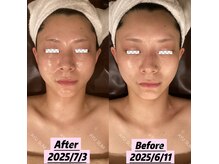 アユスリム(AYU SLIM)の雰囲気（一回でも変化できるの充実小顔◎一回でも見違えるような驚き結果）