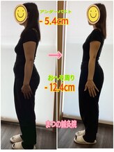 まつの鍼灸院/ぽっこりお腹がぺったんこに