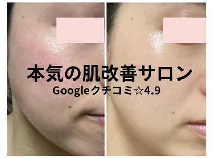 ハピスリー(Hapisley)の写真