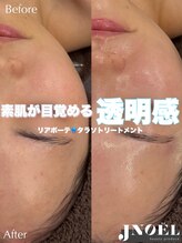 ジェノール 飾磨本店(JNOEL)/素肌目覚める！透明感