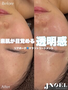 ジェノール 飾磨本店(JNOEL)/素肌目覚める！透明感