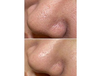 サイ(Sai)/before⇒after