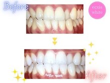 エクシアホワイト 立川南口店/エクシア立川南口店