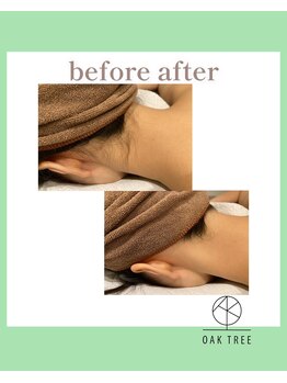 オークツリー(oak tree)/Before After
