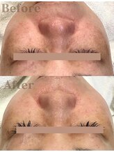 ディレイア ザ コスメ 有楽町マルイ店(direia the cosme)&nbsp;50代 （女性）