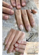 ネイル サロンアンドスクール リッシュ(Nail Salon&School riche)/深爪育成スカルプ