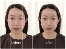 アキュモンド 渋谷院(acumond)/acumondコース初回と3回目の変化