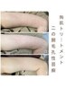 二の腕【REVI】触りたくなる肌へ！毛穴のぶつぶつ＆ザラつき徹底ケア◎