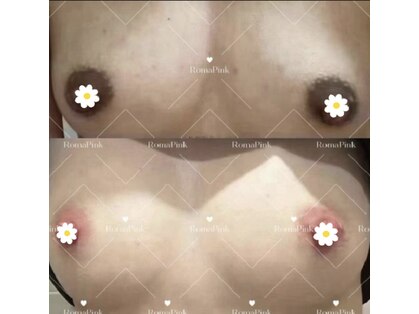 パシテア(Pasithea)の写真