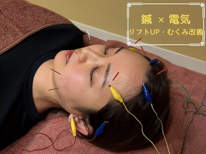 ティータートッター鍼灸院(TEETER TOTTER鍼灸院)の写真