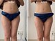 サロン アイプラス(salon i plus)の写真/フェイシャルもボディメイクも。一人ひとりのお悩みに寄り添うトータルビューティーサロン。