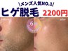 6周年記念♪【メンズ】青髭とお別れ☆ヒゲ脱毛 まずはお試し！ 40分