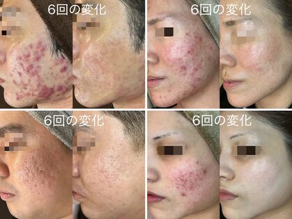 フルール ニコ(Fleur Nico)の写真