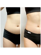 ザ ボディメイク(THE BODY MAKE)/ウルトラ痩身！