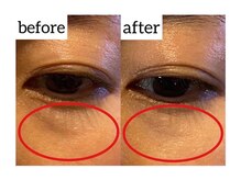 アクティブエイジング 金沢新竪町店/エンビロン　オトナ目元