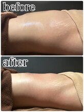 サロンチョコ(salon choco)/最新機で痩身エステ