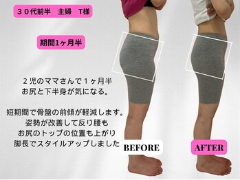 ビジリンヌ/ビフォーアフター1ヶ月半