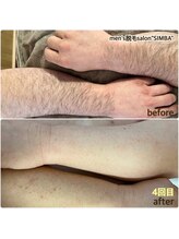 メンズ シンバ(SIMBA)/◯before→after◯
