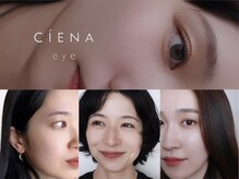 シエナ アイ(CIENA eye)