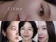 シエナ アイ(CIENA eye)の写真