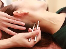 いちまる鍼灸院/美容ていしん　リフトアップ小顔