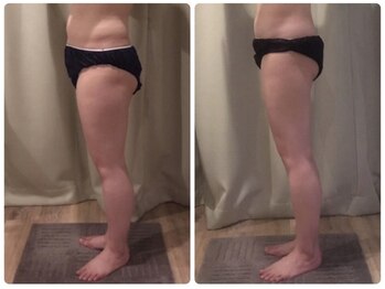 クラン シュプール 表参道店/【むくみ/脚/冷え】