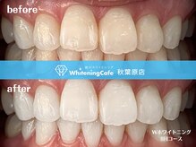 ホワイトニングカフェ 秋葉原店(WhiteningCafe)