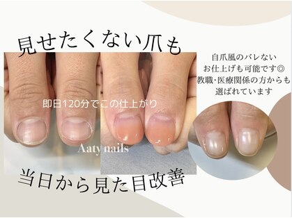 アーティネイルズ(Aaty Nails)の写真