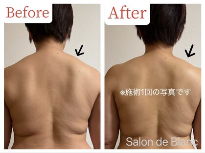 サロン ド ブラン(Salon de Blanc)の写真